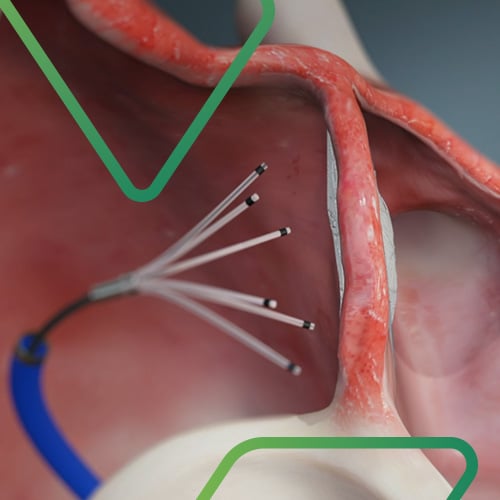 Preclinical Success Recross Cardio