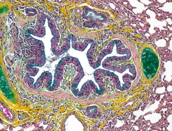 PCS Histopathology services - Medium