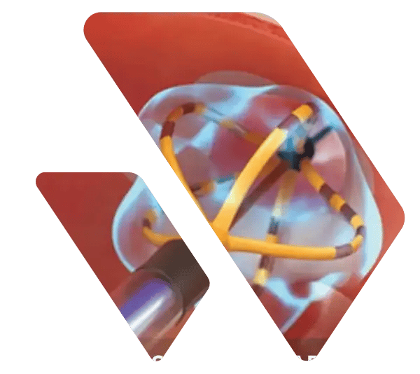 cv-case-2