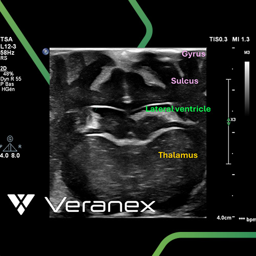 Closing the Imaging Gap in Preclinical Neurosurgery