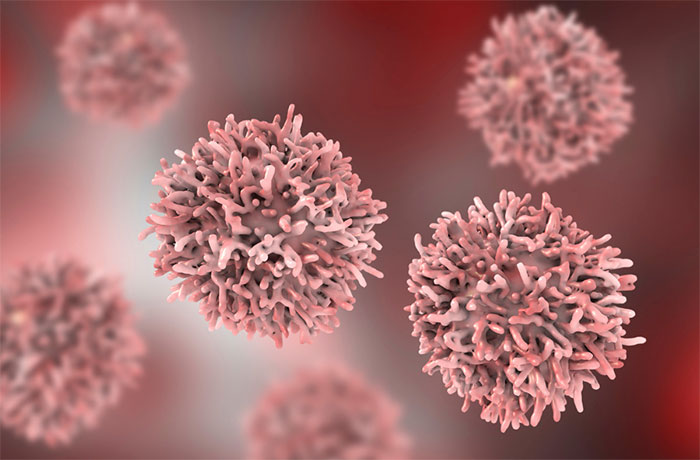 Addressing Inequity in Healthcare – A Case Study of Tackling Liver Cancer in New Zealand