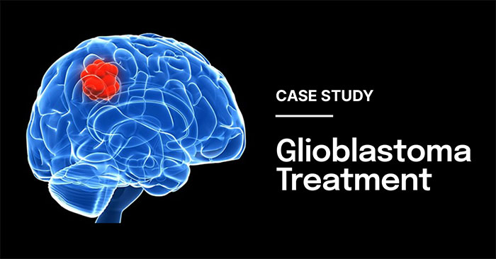 Reducing the 90% Recurrence Rate for Glioblastoma Treatment Through an Implantable Device for the Delivery of Stem Cells