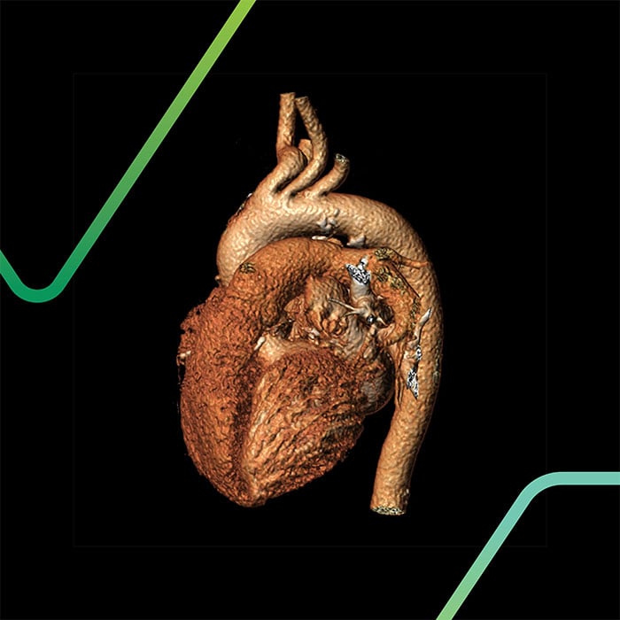 The Strategic Science of Optimal Preclinical Model Determination, Selection and Development
