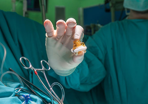 interventional-cardiology