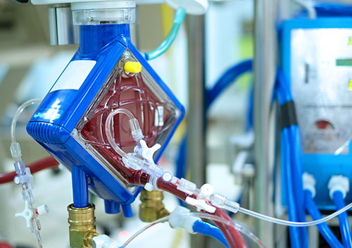 mech-circulatory-support