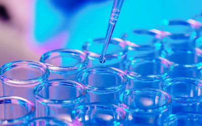 Exploring the Assay Development Pipeline for In-Vitro Diagnostics (IVDs)